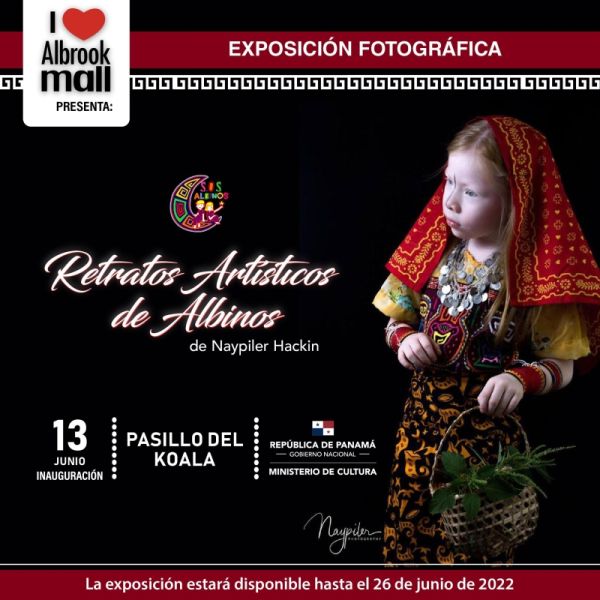 RETRATOS ARTÍSTICOS DE ALBINOS